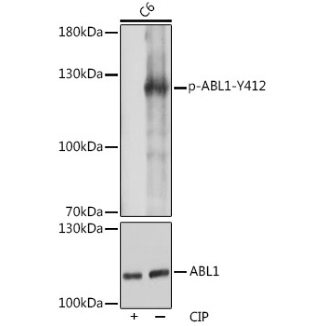 Phospho-c-Abl-Y412 Rabbit Polyclonal Antibody