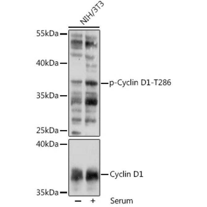 Phospho-Cyclin D1-T286 Rabbit Polyclonal Antibody