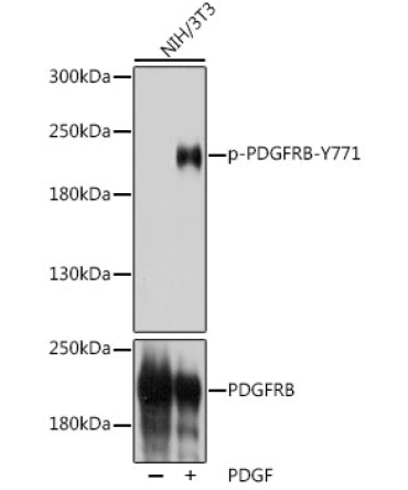 Phospho-PDGFRB-Y771 Rabbit Polyclonal Antibody