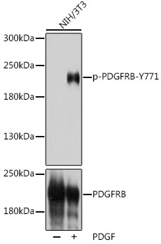 Phospho-PDGFRB-Y771 Rabbit Polyclonal Antibody