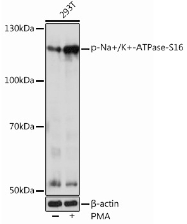 Phospho-Na+/K+-ATPase-S16 Rabbit Polyclonal Antibody