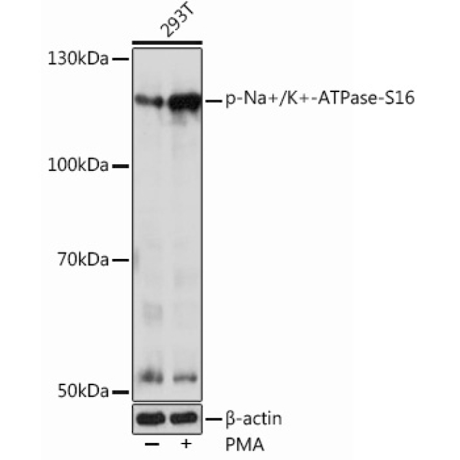 Phospho-Na+/K+-ATPase-S16 Rabbit Polyclonal Antibody