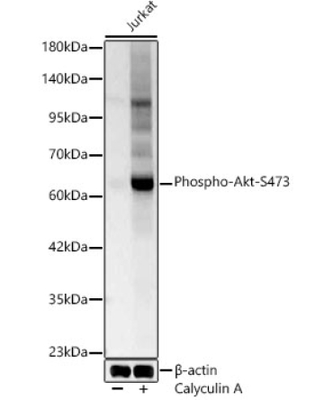 Phospho-Akt-S473 Rabbit Polyclonal Antibody