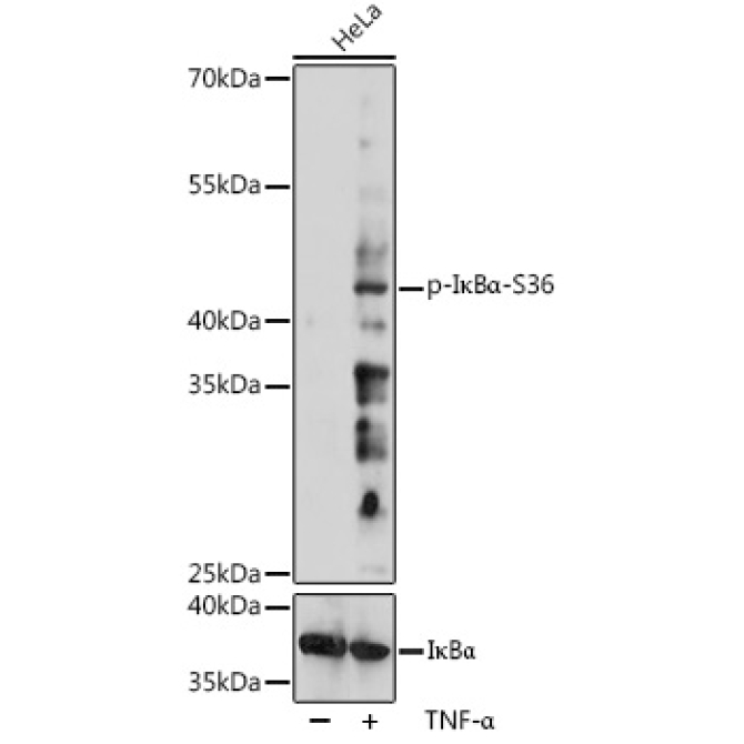 Phospho-I?BAlpha-S36 Rabbit Polyclonal Antibody