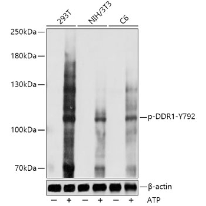 Phospho-DDR1-Y792 Rabbit Polyclonal Antibody