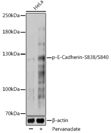 Phospho-E-Cadherin-S838/S840 Rabbit Polyclonal Antibody