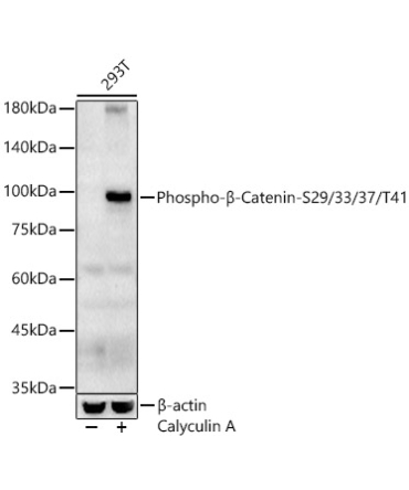 Phospho-Beta-Catenin-S29/33/37/T41 Rabbit Polyclonal Antibody