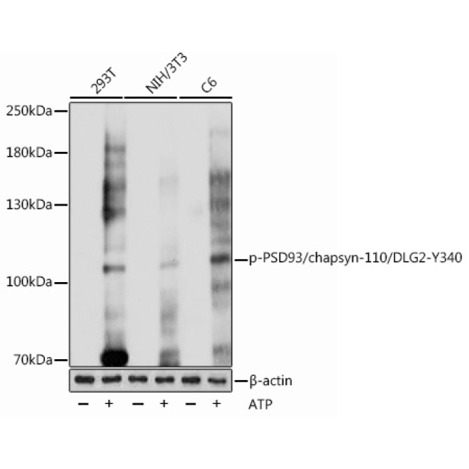 Phospho-PSD93/chapsyn-110/DLG2-Y340 Rabbit Polyclonal Antibody
