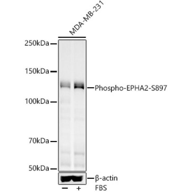 Phospho-EPHA2-S897 Rabbit Polyclonal Antibody