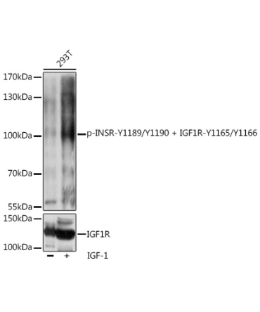 Phospho-INSR-Y1189/Y1190 + IGF1R-Y1165/Y1166 Rabbit Polyclonal Antibody