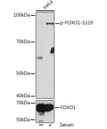 Phospho-FOXO1-S319 Rabbit Polyclonal Antibody