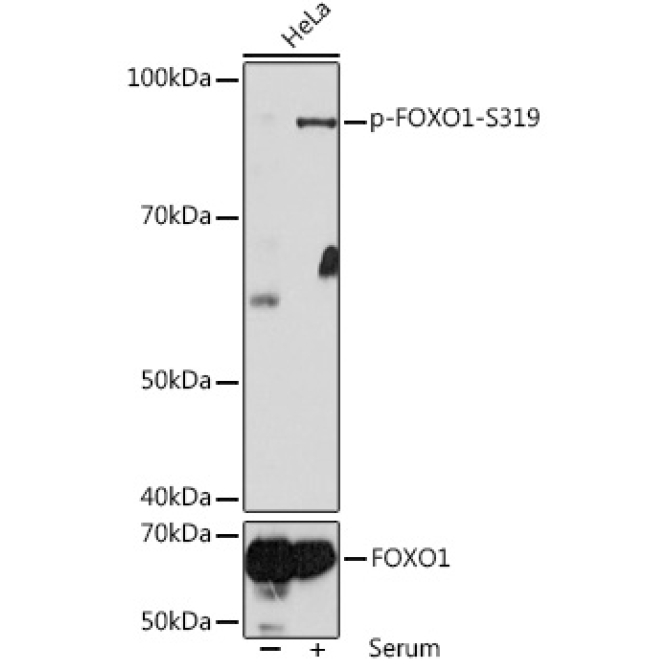 Phospho-FOXO1-S319 Rabbit Polyclonal Antibody