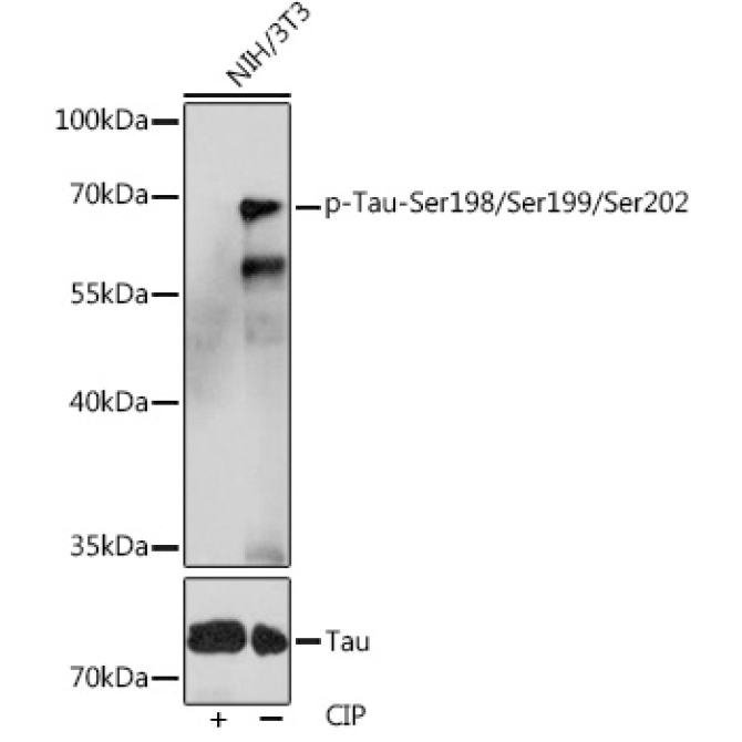 Phospho-Tau-Ser198/Ser199/Ser202 Rabbit Polyclonal Antibody