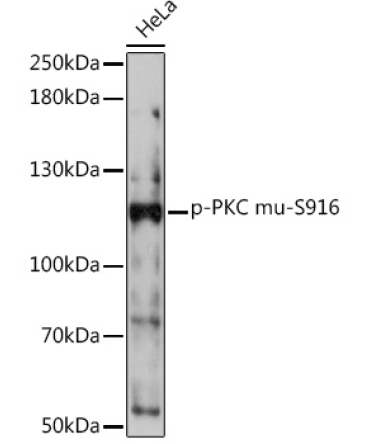 Phospho-PKC mu-S916 Rabbit Polyclonal Antibody