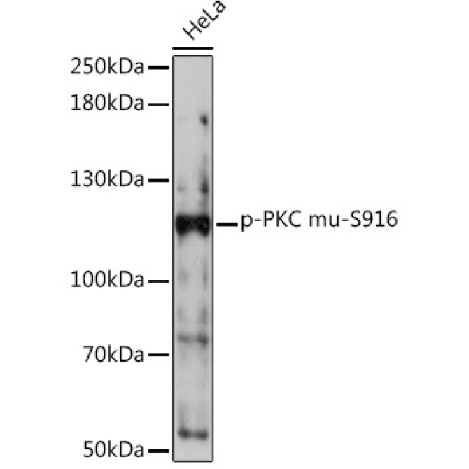Phospho-PKC mu-S916 Rabbit Polyclonal Antibody
