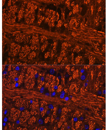 Phospho-Tau-Ser404 Rabbit Polyclonal Antibody