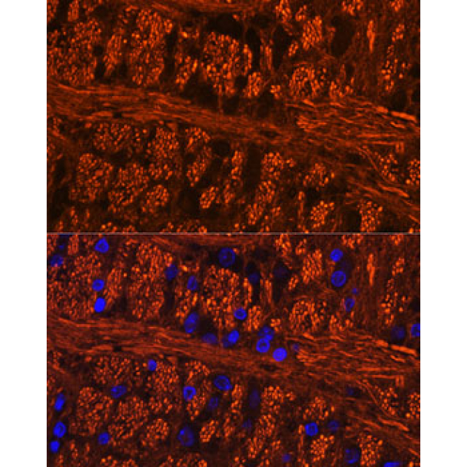 Phospho-Tau-Ser404 Rabbit Polyclonal Antibody