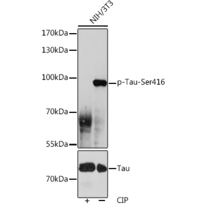 Phospho-Tau-Ser416 Rabbit Polyclonal Antibody