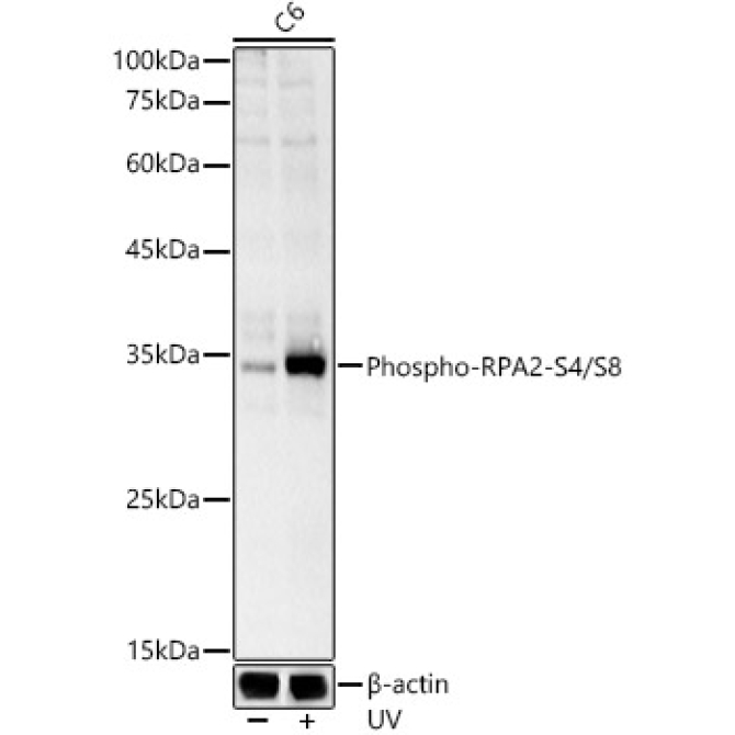 Phospho-RPA2-S4/S8 Rabbit Polyclonal Antibody