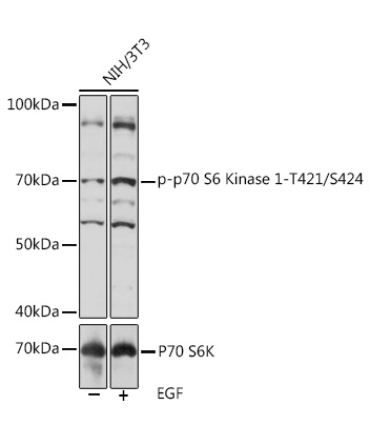 Phospho-p70 S6 Kinase 1-T421/S424 Rabbit Polyclonal Antibody