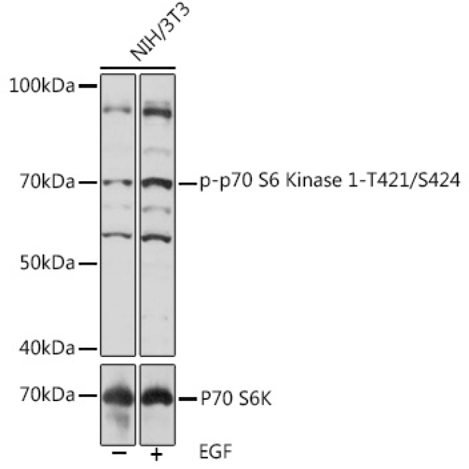 Phospho-p70 S6 Kinase 1-T421/S424 Rabbit Polyclonal Antibody