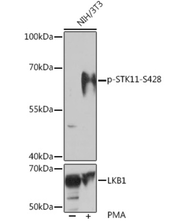 Phospho-STK11-S428 Rabbit Polyclonal Antibody