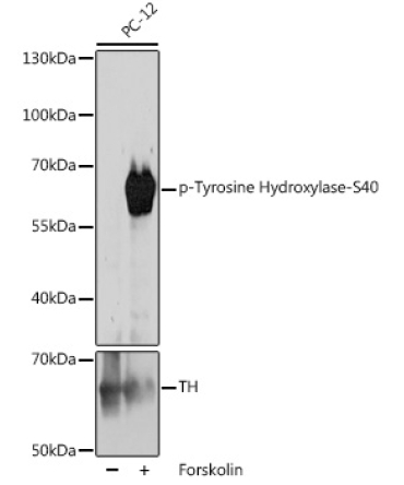 Phospho-Tyrosine Hydroxylase-S40 Rabbit Polyclonal Antibody