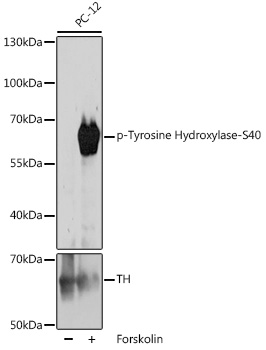 Phospho-Tyrosine Hydroxylase-S40 Rabbit Polyclonal Antibody