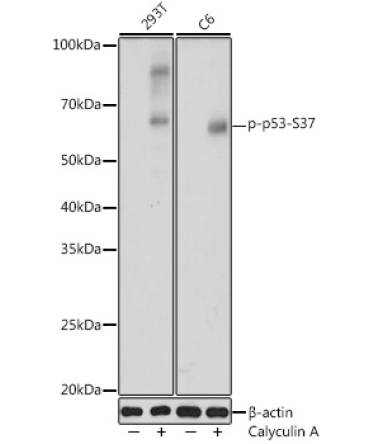 Phospho-p53-S37 Rabbit Polyclonal Antibody