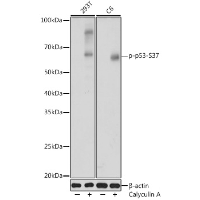 Phospho-p53-S37 Rabbit Polyclonal Antibody