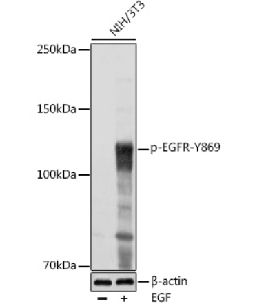 Phospho-EGFR-Y869 Rabbit Polyclonal Antibody