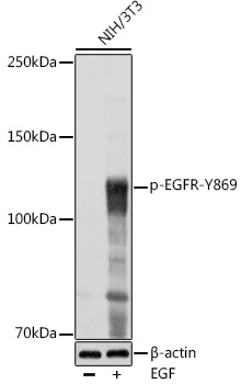 Phospho-EGFR-Y869 Rabbit Polyclonal Antibody