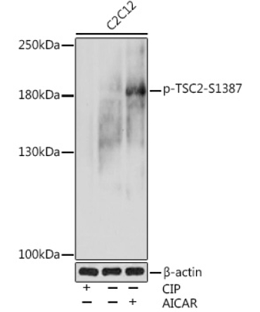 Phospho-TSC2-S1387 Rabbit Polyclonal Antibody