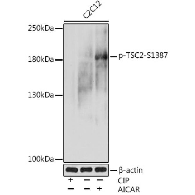 Phospho-TSC2-S1387 Rabbit Polyclonal Antibody
