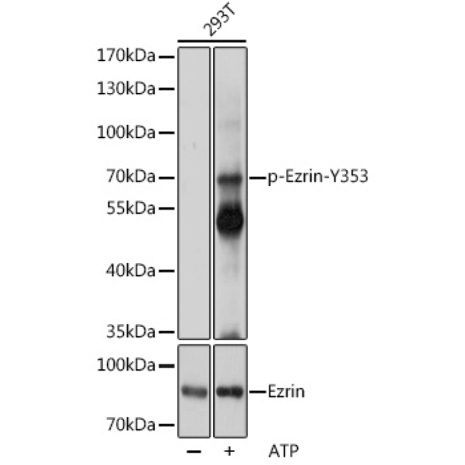 Phospho-Ezrin-Y353 Rabbit Polyclonal Antibody