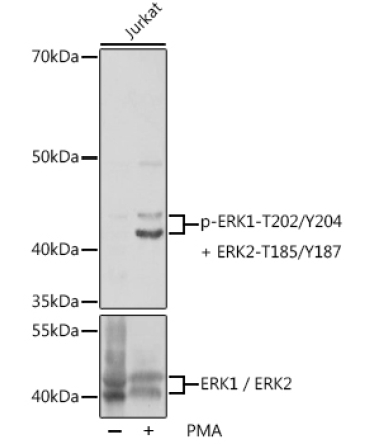 Phospho-ERK1-T202/Y204 + ERK2-T185/Y187 Rabbit Polyclonal Antibody