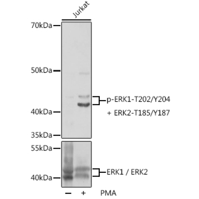 Phospho-ERK1-T202/Y204 + ERK2-T185/Y187 Rabbit Polyclonal Antibody
