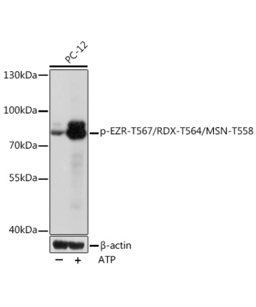 Phospho-EZR-T567/RDX-T564/MSN-T558 Rabbit Polyclonal Antibody