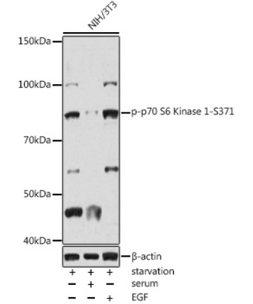 Phospho-p70 S6 Kinase 1-S371 Rabbit Polyclonal Antibody