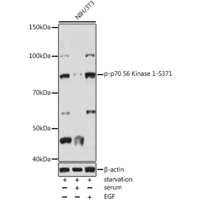 Phospho-p70 S6 Kinase 1-S371 Rabbit Polyclonal Antibody
