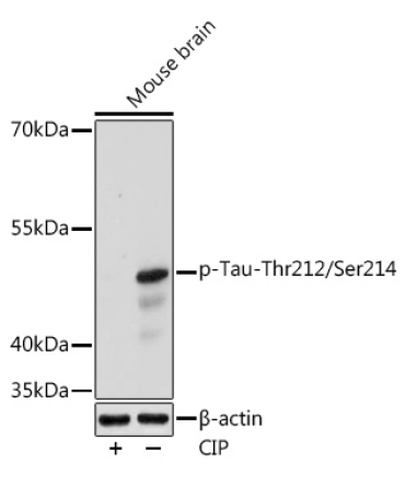 Phospho-Tau-Thr212/Ser214 Rabbit Polyclonal Antibody