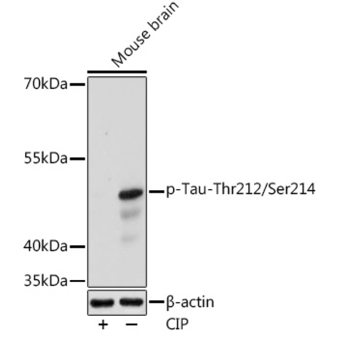 Phospho-Tau-Thr212/Ser214 Rabbit Polyclonal Antibody