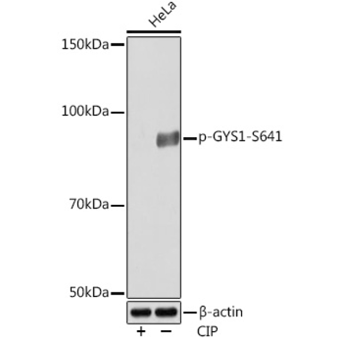 Phospho-GYS1-S641 Rabbit Monoclonal Antibody