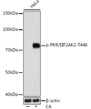 Phospho-PKR/EIF2AK2-T446 Rabbit Monoclonal Antibody
