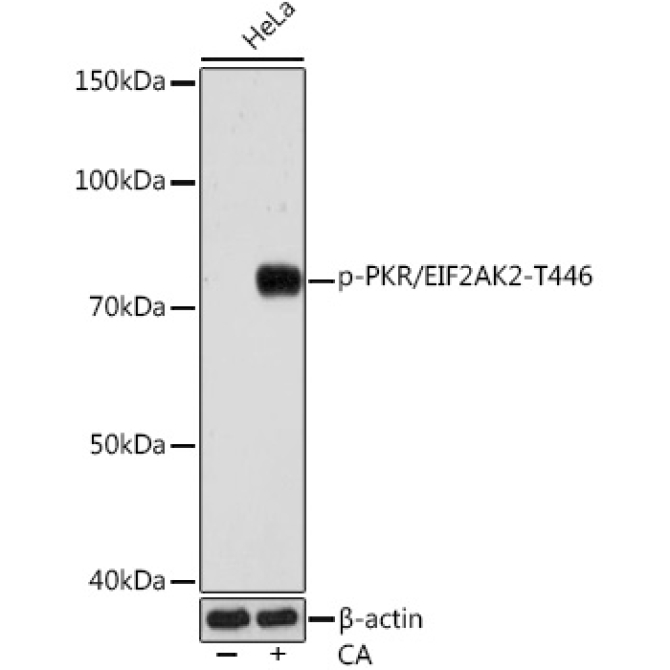 Phospho-PKR/EIF2AK2-T446 Rabbit Monoclonal Antibody