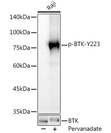 Phospho-BTK-Y223 Rabbit Monoclonal Antibody
