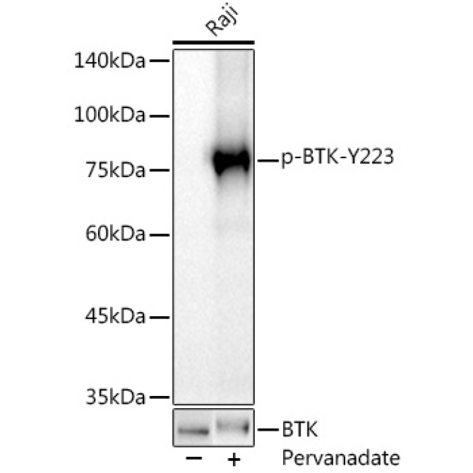 Phospho-BTK-Y223 Rabbit Monoclonal Antibody
