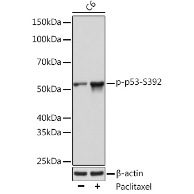 Phospho-p53-S392 Rabbit Monoclonal Antibody