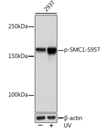 Phospho-SMC1-S957 Rabbit Monoclonal Antibody