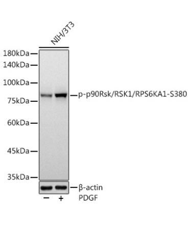 Phospho-p90Rsk/RSK1/RPS6KA1-S380 Rabbit Monoclonal Antibody